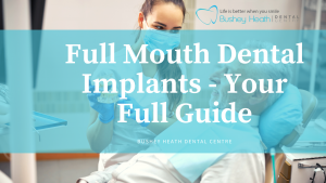 Full Mouth Dental Implants - Your Full Guide
